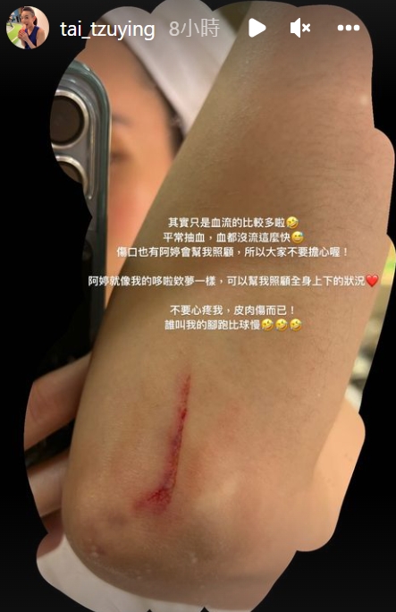 戴資穎貼出傷口的照片,請球迷不用擔心。(圖/翻攝自tai_tzuying IG)