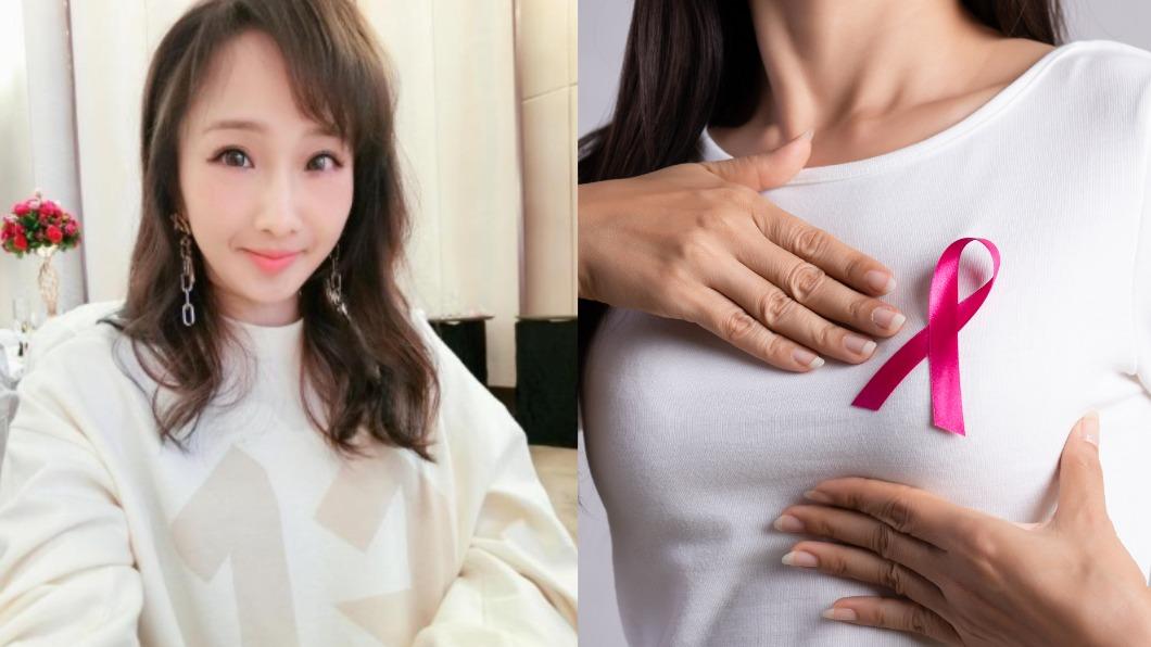 朱俐靜病逝！乳癌末期存活率僅3成　醫籲2族群該檢查