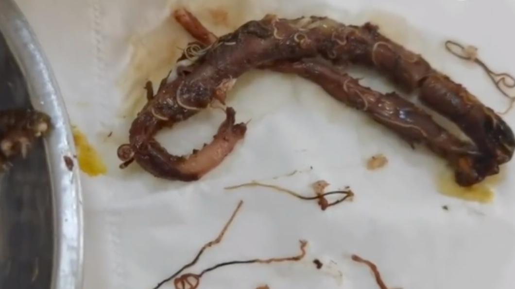 鱔魚內臟滿是寄生蟲,畫面超駭人。(圖/翻攝自微博)