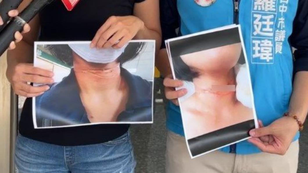 台中驚傳割喉!女騎車「突被細繩勒脖」留12公分傷疤