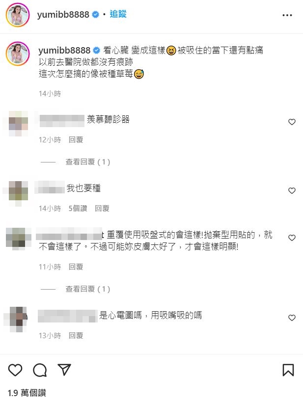 Yumi.k解釋,是因為檢查才會有向重草莓痕跡。(圖/翻攝自Yumi.k_IG)