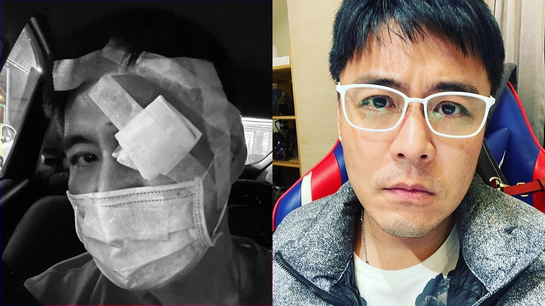 劉至翰無預警公開眼部包紮照嚇壞網友。（圖／翻攝自劉至翰臉書）