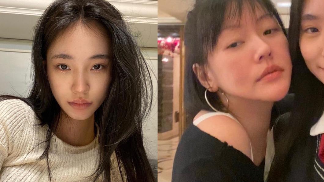 小S二女兒瘋「夾鼻器」 醫師曝危險性:恐壞死