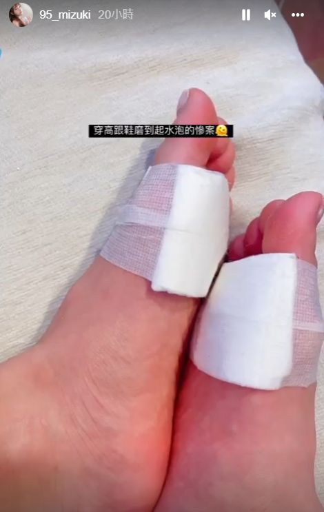「樂天女孩」林襄透露穿高跟鞋跳舞腳起水泡。（圖／翻攝自林襄IG）
