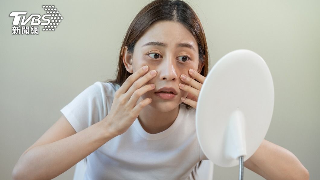 睡飽仍有「大大黑眼圈」？　醫揭5成因：過敏族群最容易