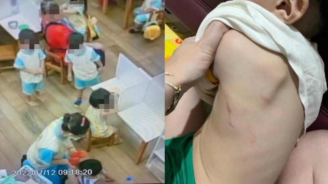 4歲男童滿身傷!桃市幼兒園驚爆虐童 一查老師竟無照