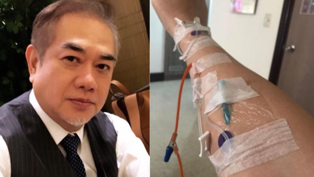 拍戲一半心臟病發!本土劇男星「身插5管子」電擊搶救