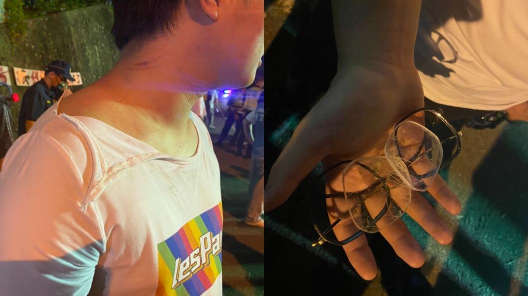 有學生遭黑衣人拖入人群毆打,鏡片毀損且身上有傷痕、衣服破損,且全身都有遭胡椒噴霧接觸的燒灼感。(圖/洪申翰辦公室提供)