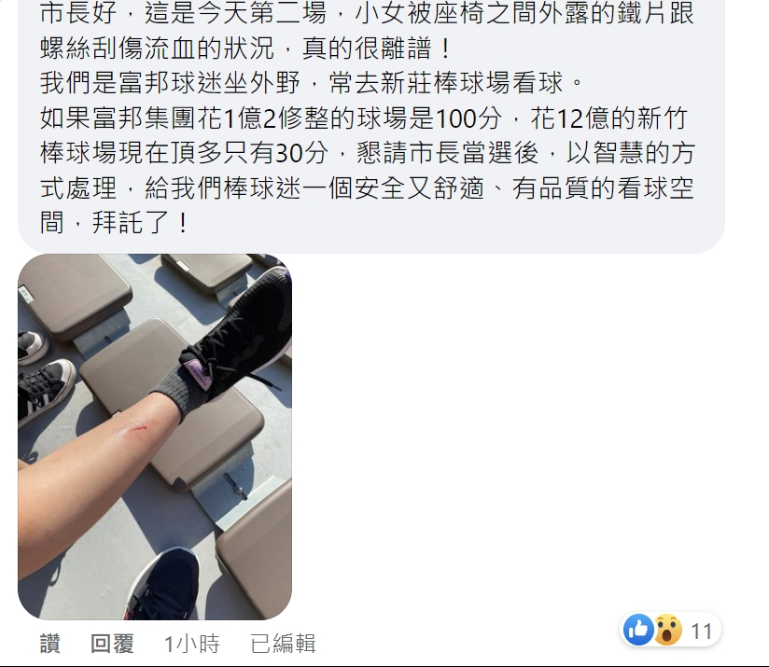 球迷反映自家孩童遭球場座位割傷。(圖/翻攝自臉書)