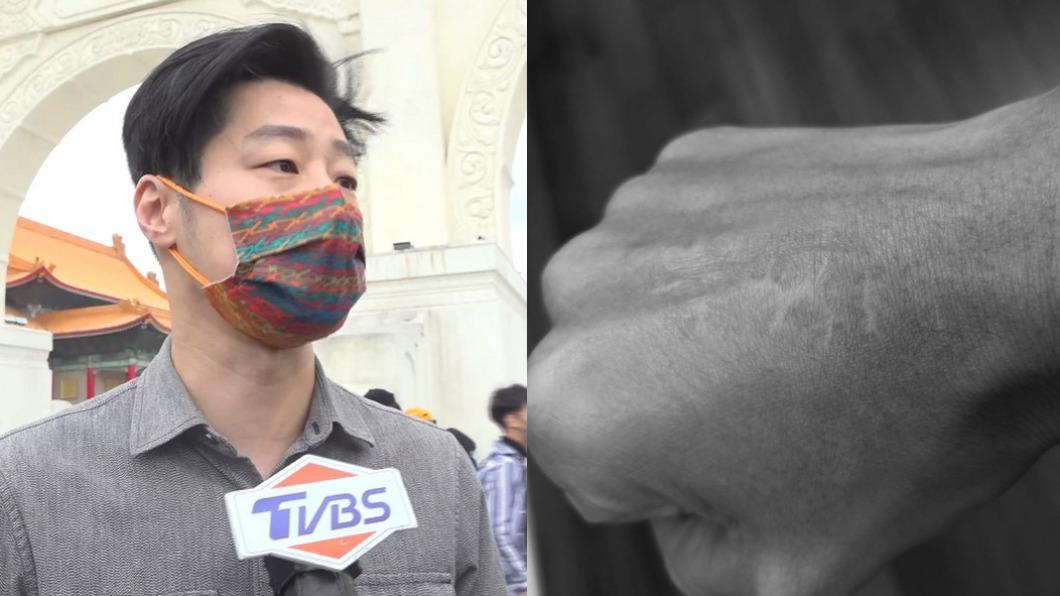 頭手全身傷！林昶佐遭爸「拿酒瓶狠砸」　痛撕家暴瘡疤