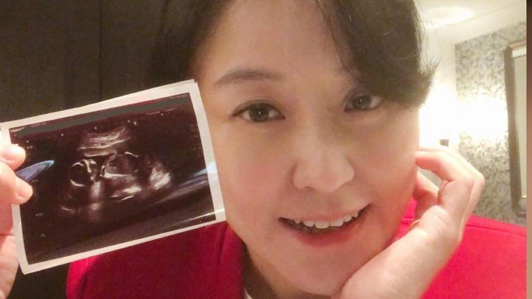 45歲「國民姑姑」海裕芬喜曬超音波 忍到殺青宣布當媽:有一輩子小跟班了