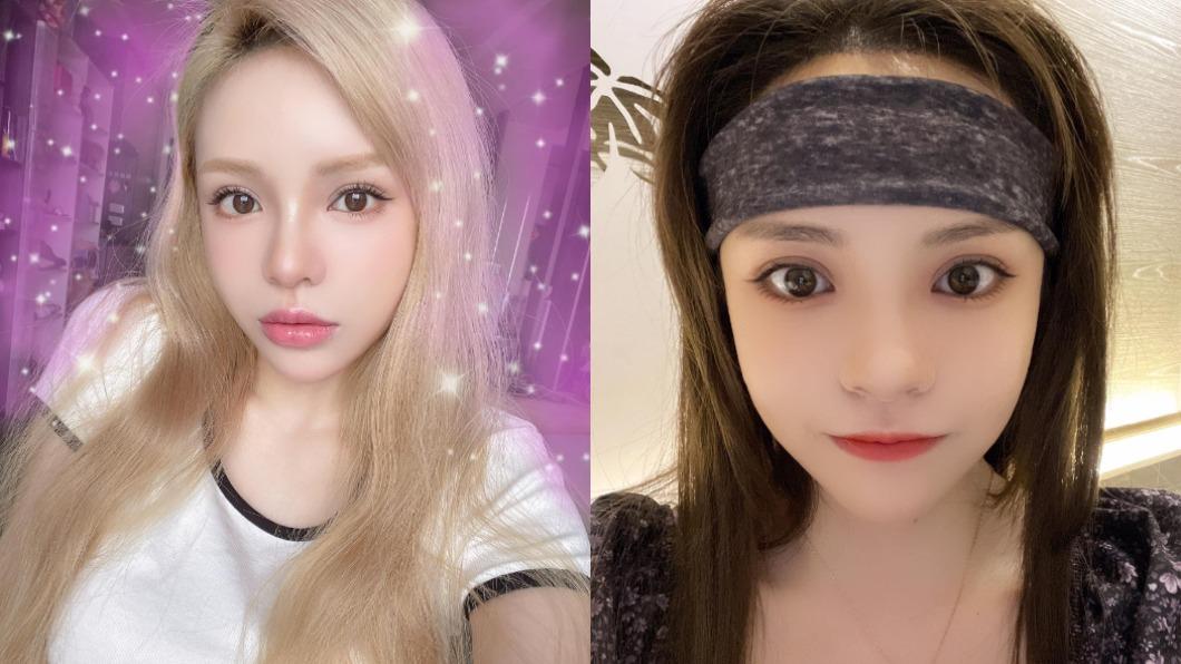 別小看愛美極限！童顏女星挨針救髮際線　前後對比照曝光