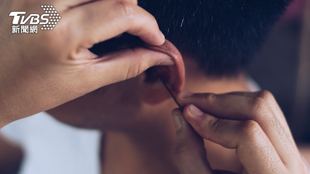 悚！耳垢竟會「吃掉耳骨」　2狀況快找醫師清耳朵