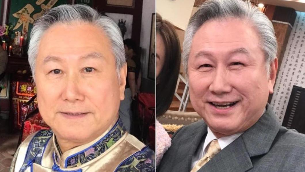 66歲資深男星「爆破炸傷」！曾25％面積燒傷　遭賜死封殺