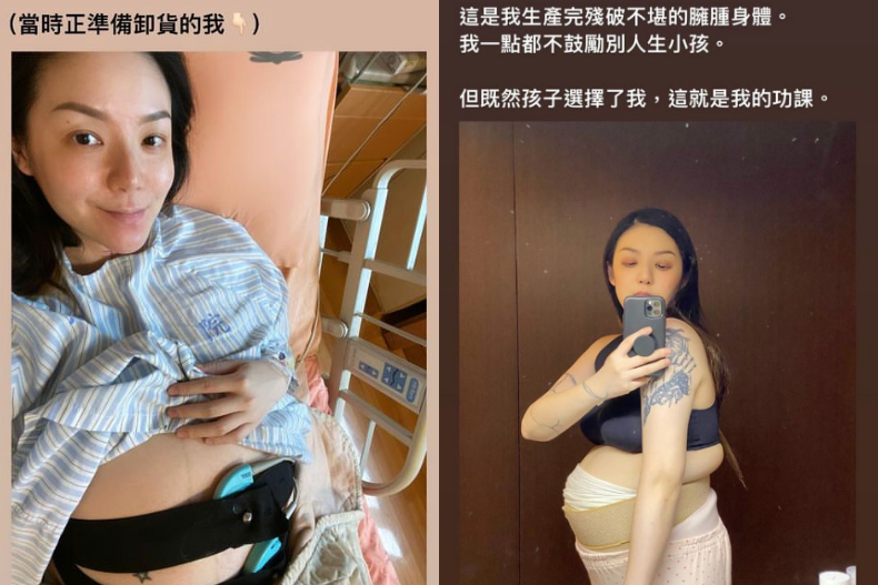 歐陽靖分享自己剖腹產後的照片（圖／翻攝自IG@imginoy）