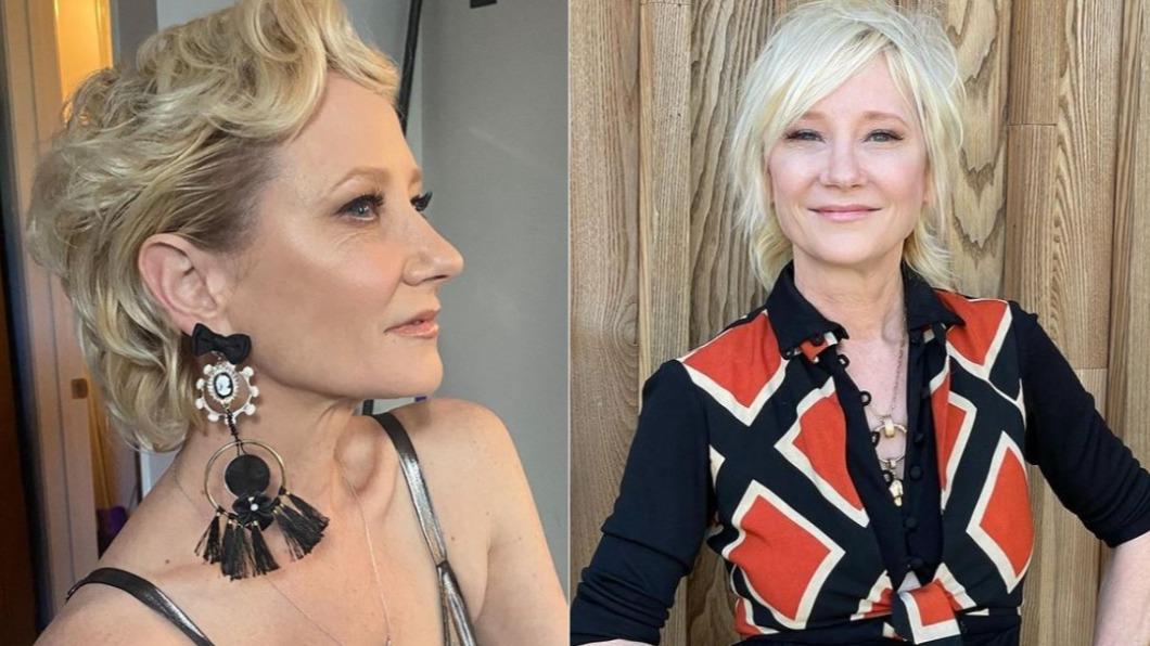 安海契目前正在醫院插管。(圖/翻攝自Anne Heche IG)