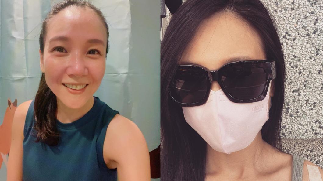 大戰太激烈!張本渝「左肩爆痛抬不起」 一照超音波慘了