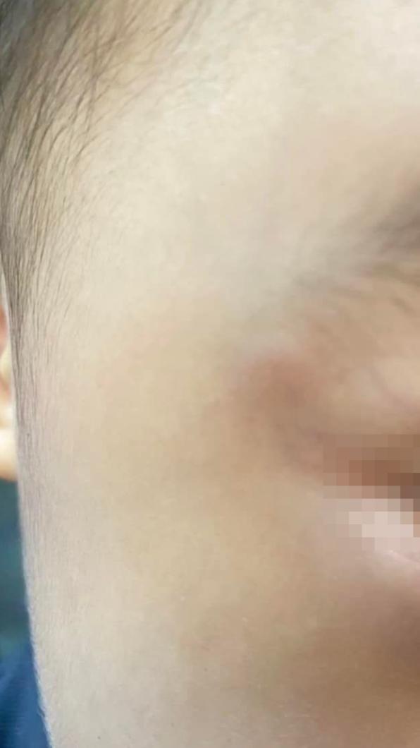 3歲男童受傷,差點傷及眼睛。(圖/翻攝自我是新莊人許明偉 臉書)