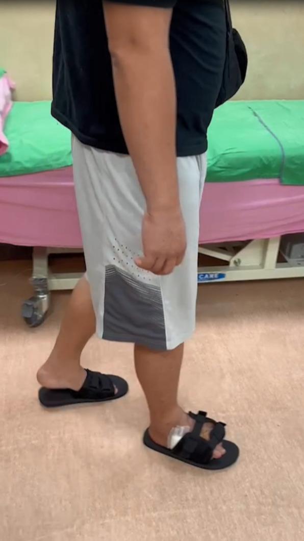 合併整形手術讓病患的腳能穿鞋(圖/TVBS)