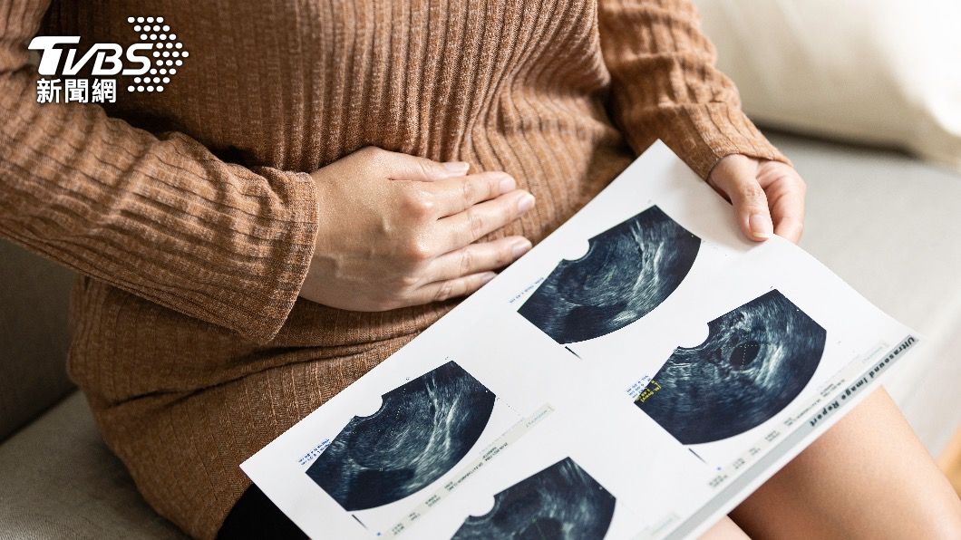 子宮體癌為我國婦女癌症發生率第 5 位 。（示意圖／shutterstock達志影像）