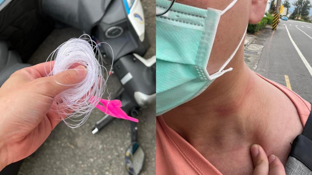騎車一半險遇劫!男突遭「風箏線勒脖」:差點回不了家