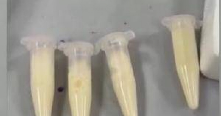 將血靜置一段時間後,竟成了「牛奶血」。(圖/翻攝自微博)