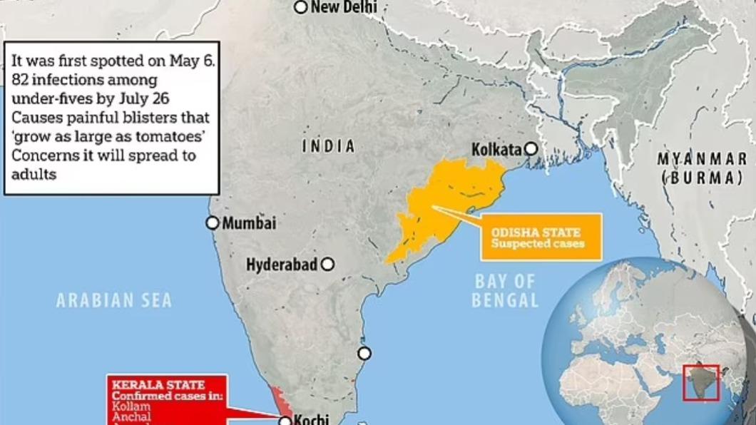 「番茄流感」最初於印度南部的喀拉拉邦（Kerala）現蹤，之後在東部的奧里薩邦 （Odisha）也出現疑似病例。（圖／翻攝自每日郵報）