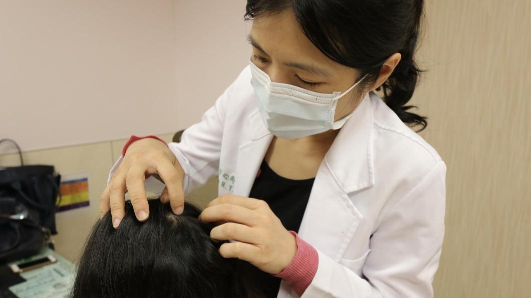 睡醒枕頭滿是頭髮！輕熟女險禿　醫揭2招自測提早防範