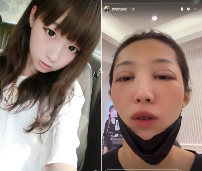 歐菈17日在限時動態上分享自己8年前的照片。(圖/翻攝自歐菈臉書)