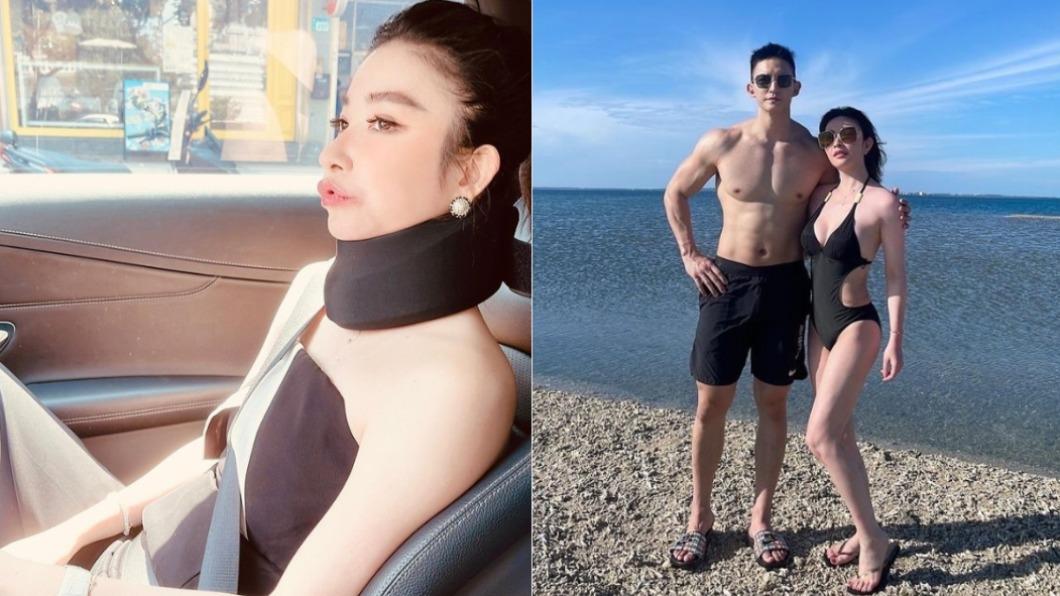 才穿婚紗報喜!許維恩頸椎神經壓迫 「肌肉撕裂」痛到吐