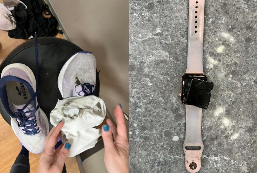 雷擊導致鞋襪破了大洞,Apple Watch也爆炸。(圖/翻攝自臉書)