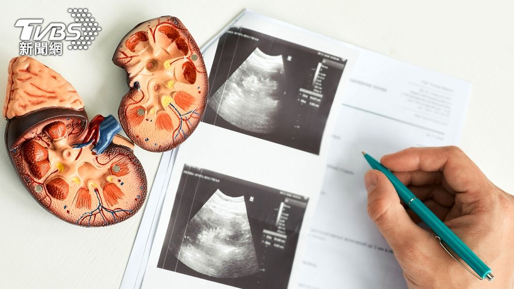 腎臟腫瘤大部分都是經由體檢或超音波意外發現。（示意圖／shutterstock達志影像）