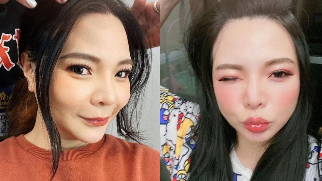 遭狠撞眉骨!教道歉「女兒1舉動」震驚小甜甜:好恐怖