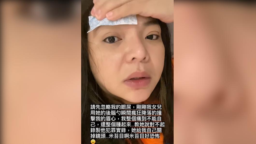 小甜甜遭女兒用頭重擊。（圖／翻攝自小甜甜（張可昀）IG）