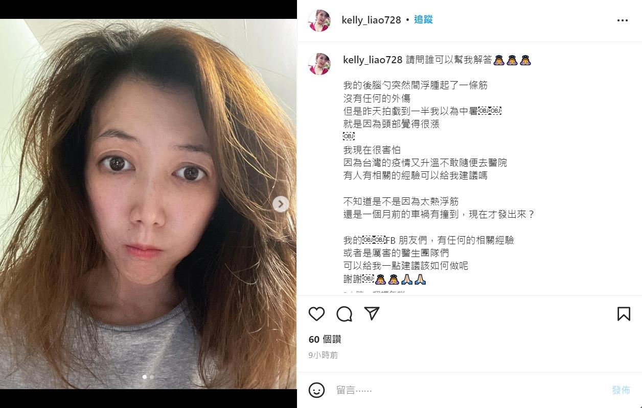 廖家儀7月出車禍被撞，近日發現後腦勺出現異狀。（圖／翻攝自廖家儀IG）