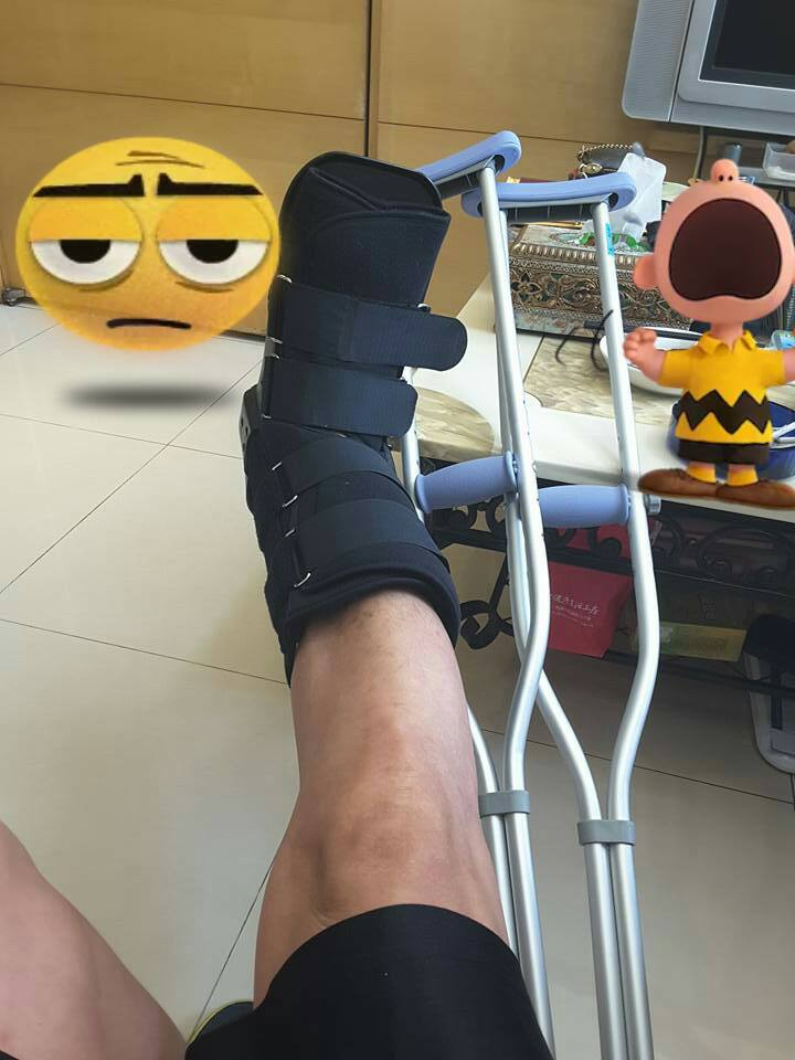 薛志正車禍腿斷掉。(圖/翻攝自薛子騛臉書)