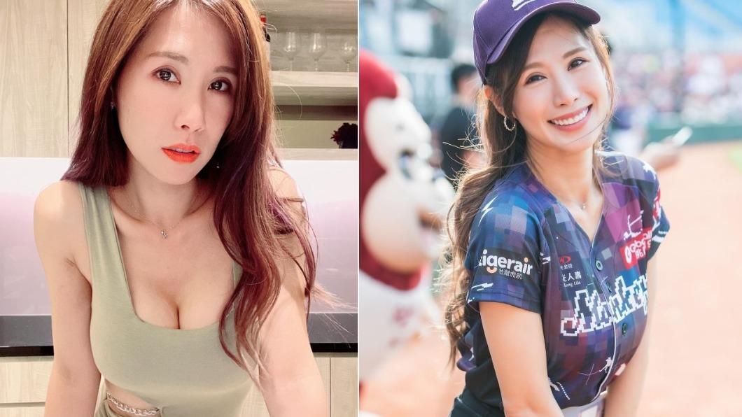 啦啦隊女神26歲懷孕!胎兒罹「先天性罕病」悲痛引產