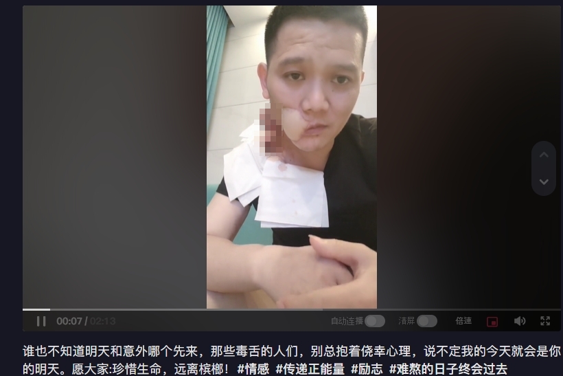 歌手傅松因口腔癌離世。(圖/翻攝自傅松抖音)