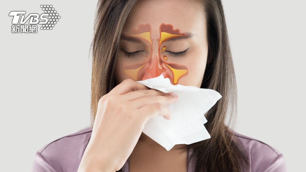 鼻竇炎會引起竇性頭痛。(示意圖/shutterstock達志影像)