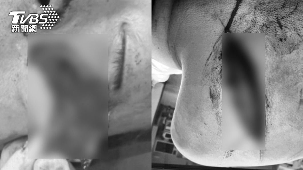 6旬男持刀追砍鄰居！他身中10多刀急送醫　只因這件事