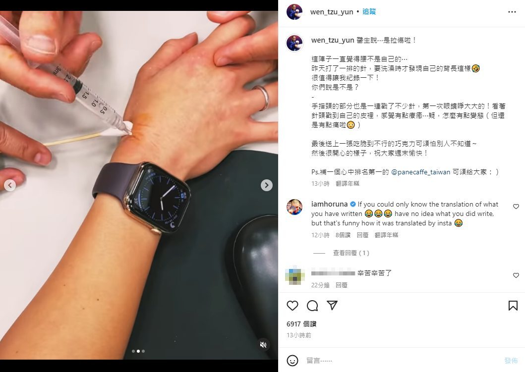 文姿云背部拉傷、手韌帶受傷,接受高濃度葡萄糖治療。(圖/翻攝自文姿云Instagram)