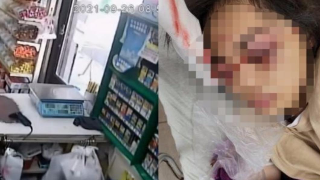 一名超商女店員願因勸說顧客別到處抽菸慘遭挖眼、毆打。(圖/翻攝自爆料公社臉書)