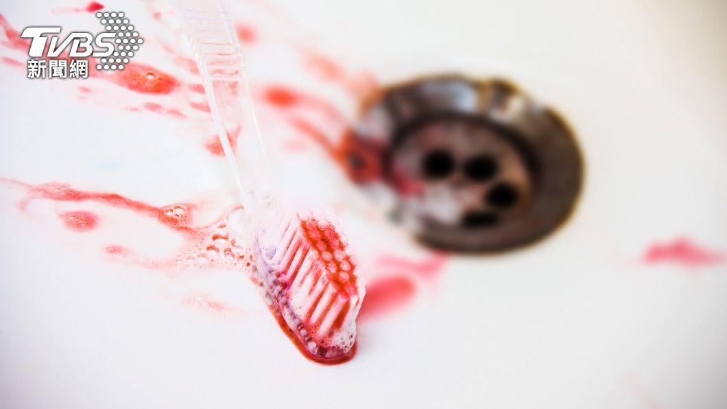 牙齦不明原因出血，要當心可能是血癌。（示意圖／shutterstock達志影像）