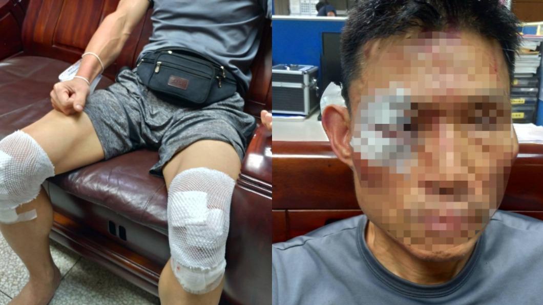 男子臉部、手腳多處受傷,已向員警提告。(圖/民眾提供)