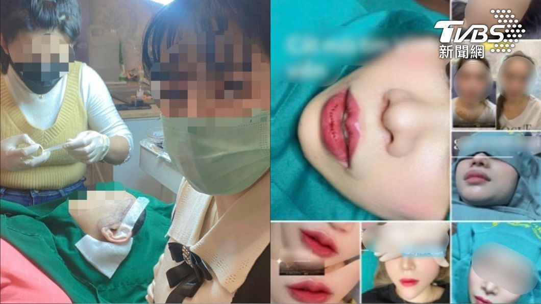 醫美黑傑克?越南外配當起整形密醫 生意興隆姪女當助手
