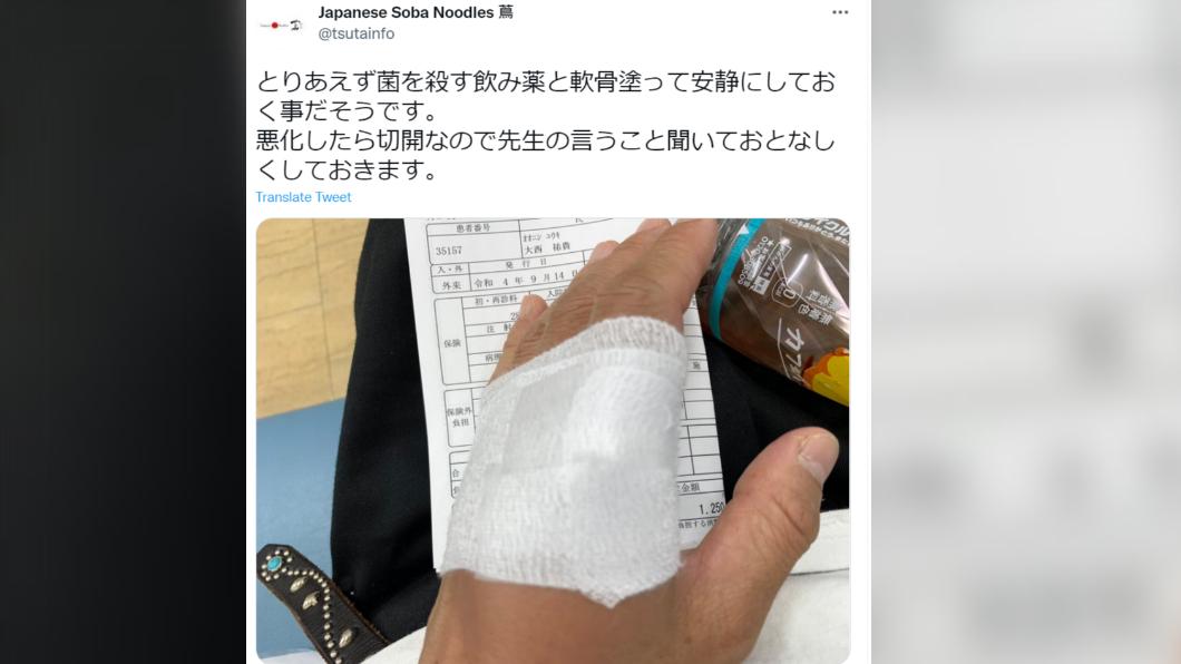 大西逝世前在推特指出手部受傷。(圖/翻攝自)