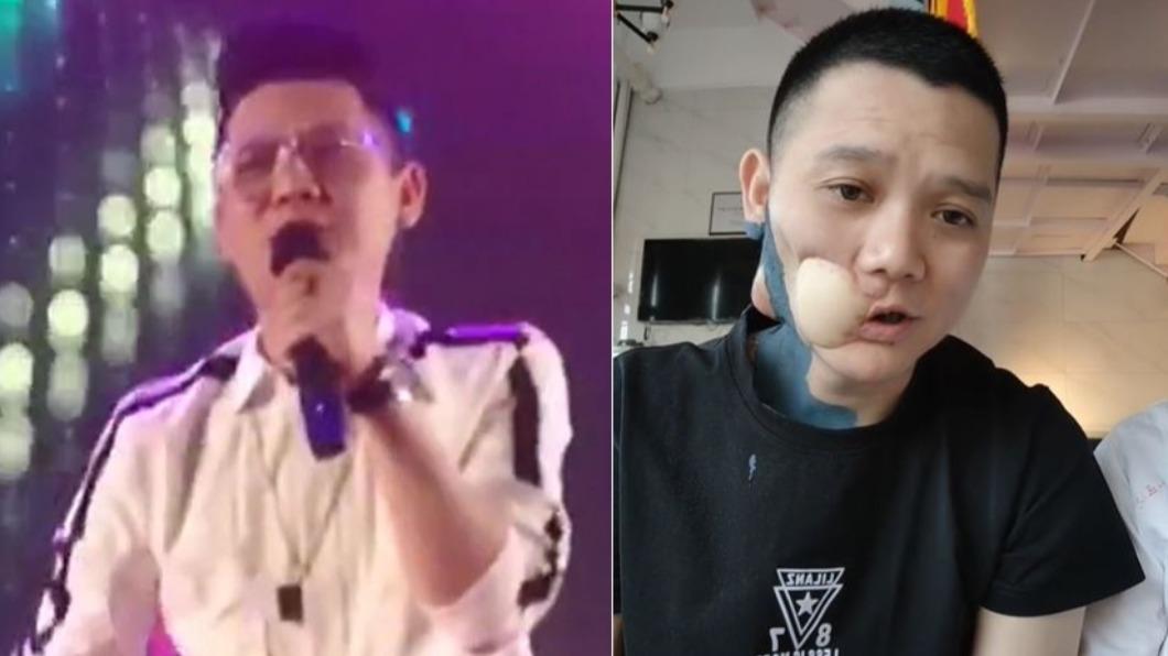 口腔癌3度復發過世!鮮肉男星「享年36歲」這食物別吃了