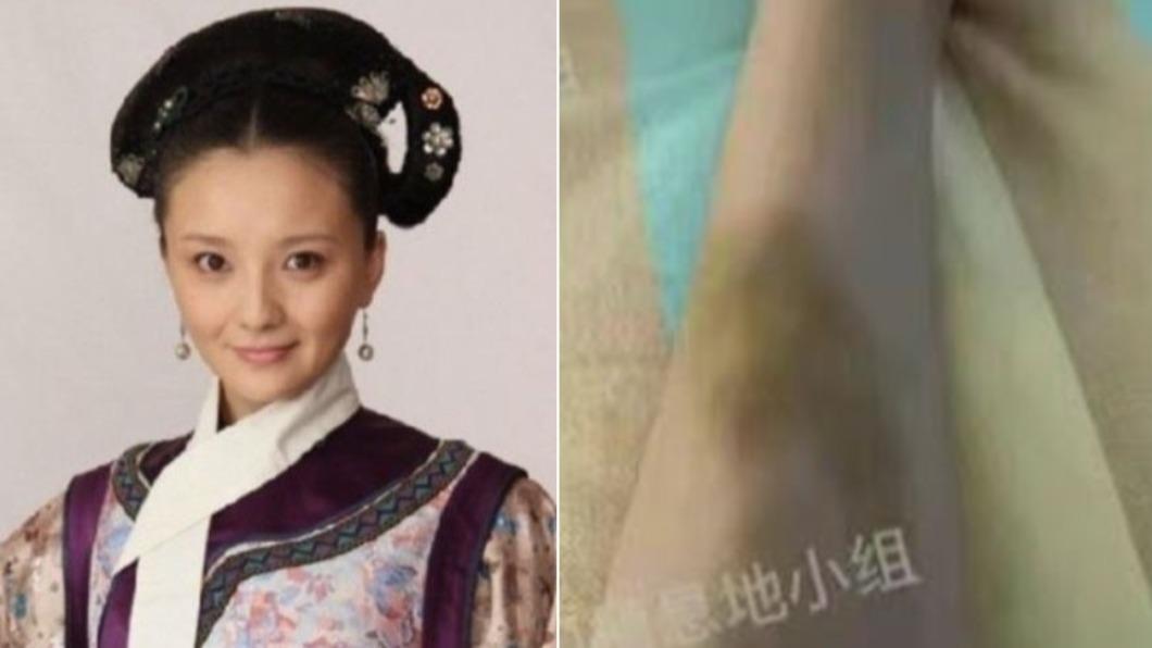 《甄嬛傳》女星痛喊「懷孕遭家暴」!大腿整片瘀青 本人發聲了