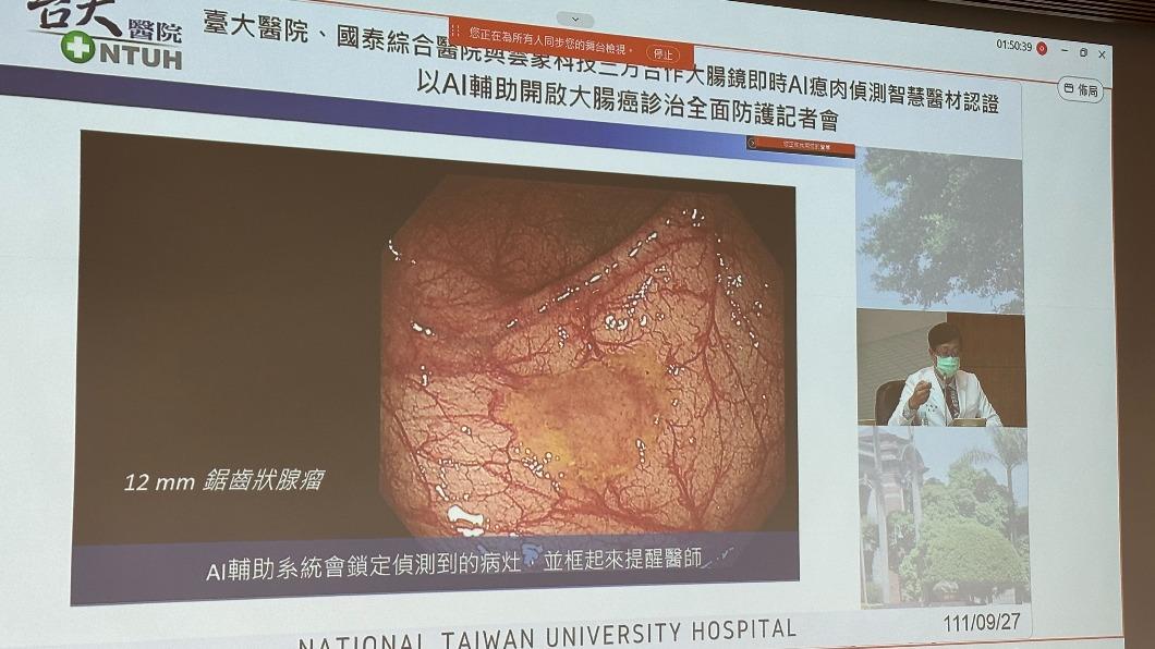 AI輔助系統可鎖定偵測到的病灶，提醒醫師。（圖／TVBS）