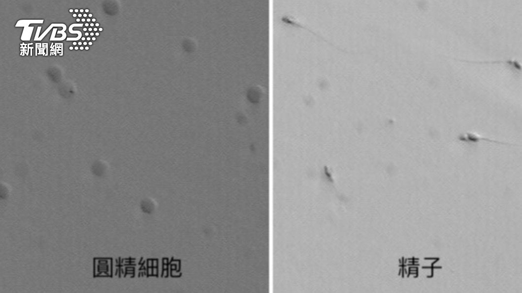 圓精細胞其實是精子製造過程中的「半成品」。(圖/台北榮總提供)